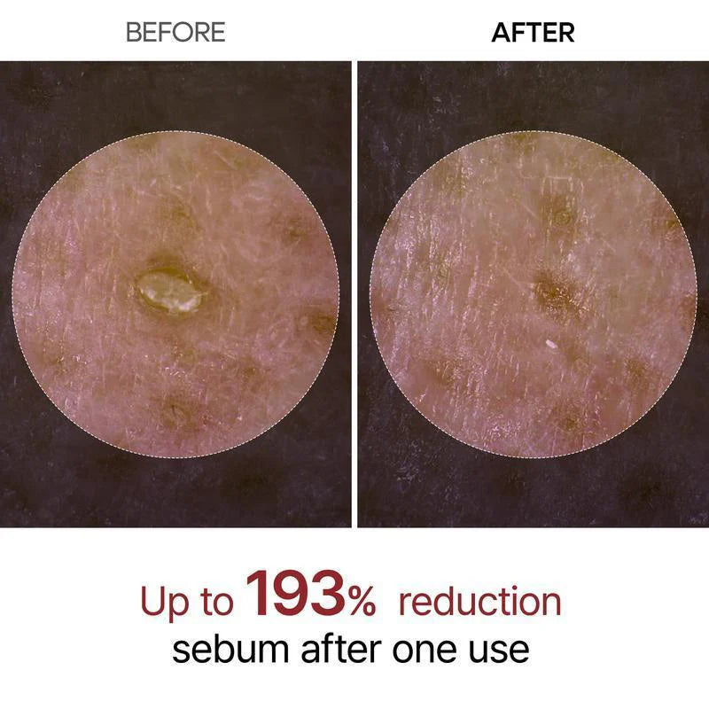 Rice Glow Peel Shot